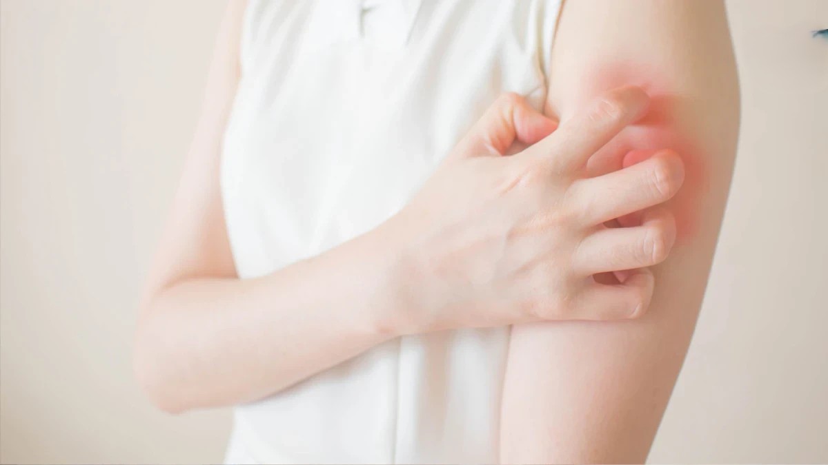 好不了的濕疹?乾癬?小心是罕見皮膚T細胞淋巴瘤