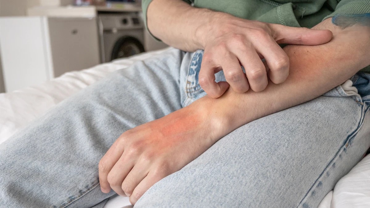 中醫調理乾癬 內外兼治 溫和改善皮膚困擾 擺脫紅疹瘙癢 重拾健康自信